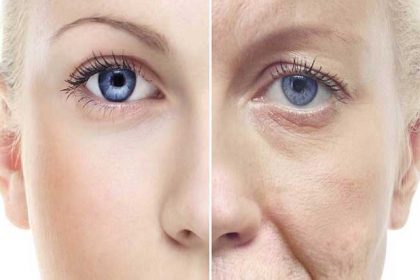 rhinoplasty-age