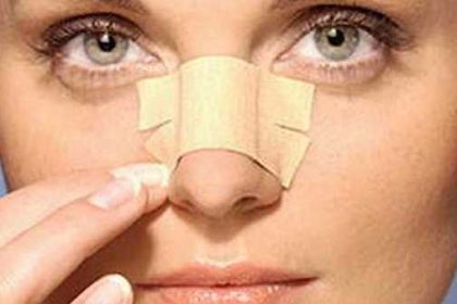 nose-taping2
