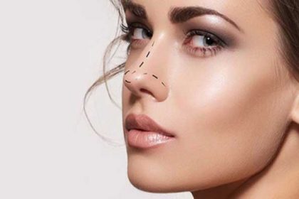 nose-platic-surgery2