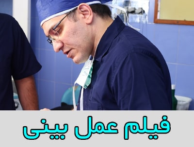 فیلم عمل بینی