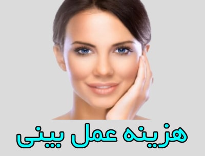 هزینه عمل بینی در تهران